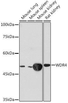 WDR4 Antibody in Western Blot (WB)