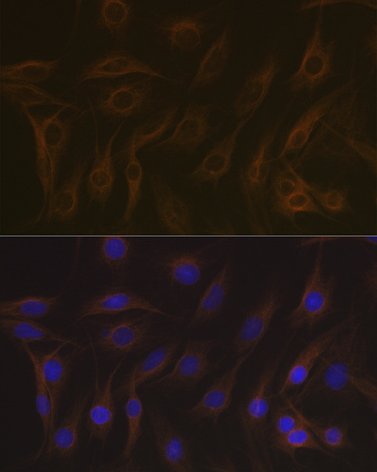 MAPRE3 Antibody in Immunocytochemistry (ICC/IF)