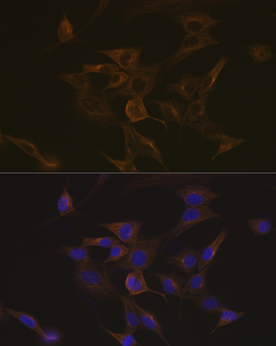 MAPRE3 Antibody in Immunocytochemistry (ICC/IF)