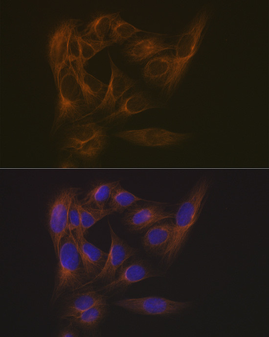 MAPRE3 Antibody in Immunocytochemistry (ICC/IF)