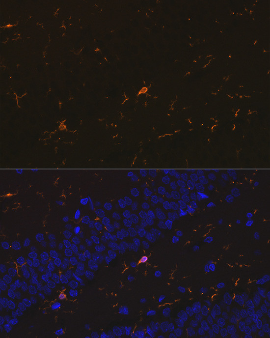 IBA1 Antibody in Immunohistochemistry (Paraffin) (IHC (P))