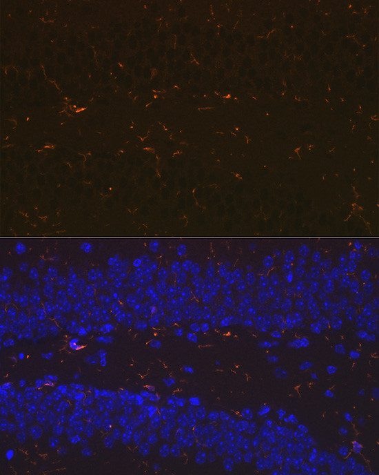 IBA1 Antibody in Immunohistochemistry (Paraffin) (IHC (P))