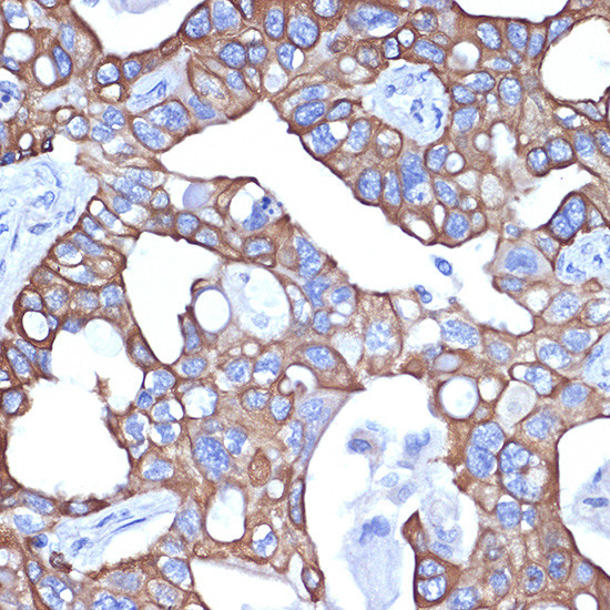 Cytokeratin 18 Antibody in Immunohistochemistry (Paraffin) (IHC (P))