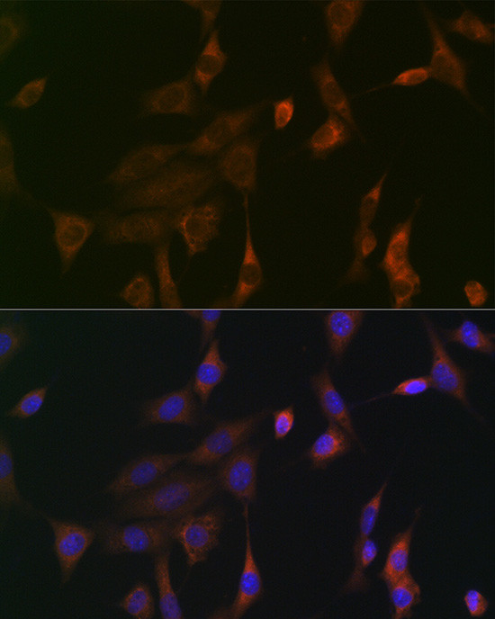 Pan Ras Antibody in Immunocytochemistry (ICC/IF)