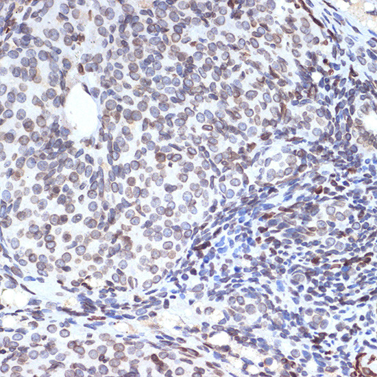 UNC84B Antibody in Immunohistochemistry (Paraffin) (IHC (P))