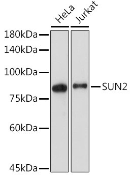 UNC84B Antibody in Western Blot (WB)