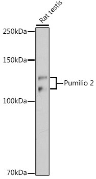 PUM2 Antibody in Western Blot (WB)