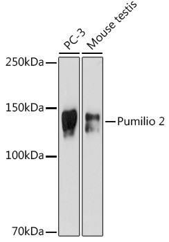 PUM2 Antibody in Western Blot (WB)