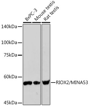 MINA53 Antibody in Western Blot (WB)