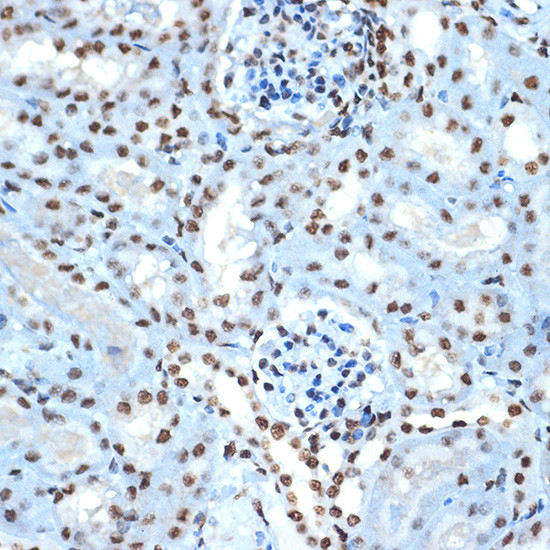 Histone H2B Antibody in Immunohistochemistry (Paraffin) (IHC (P))