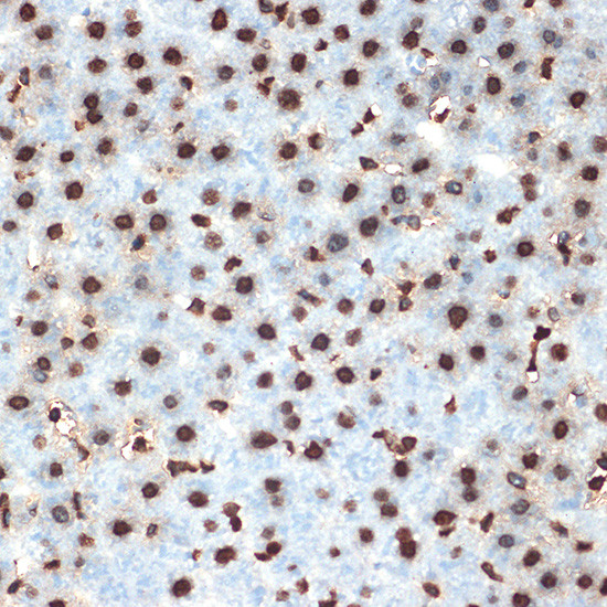 Histone H4 Antibody in Immunohistochemistry (Paraffin) (IHC (P))