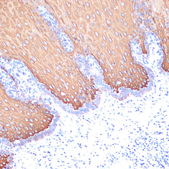 Cytokeratin 6 Antibody in Immunohistochemistry (Paraffin) (IHC (P))