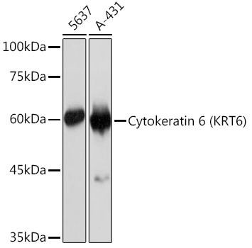 Cytokeratin 6 Antibody in Western Blot (WB)