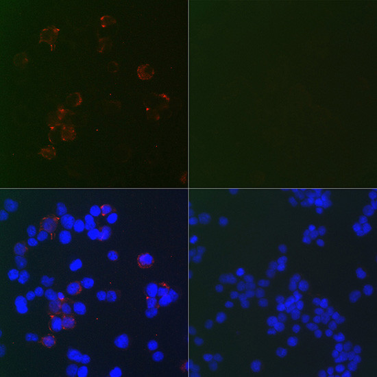 SARS-CoV-2 Nucleocapsid Antibody in Immunocytochemistry (ICC/IF)