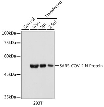 SARS-CoV-2 Nucleocapsid Antibody in Western Blot (WB)