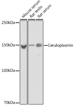Ceruloplasmin Antibody in Western Blot (WB)