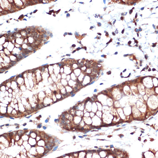 STK39 Antibody in Immunohistochemistry (Paraffin) (IHC (P))