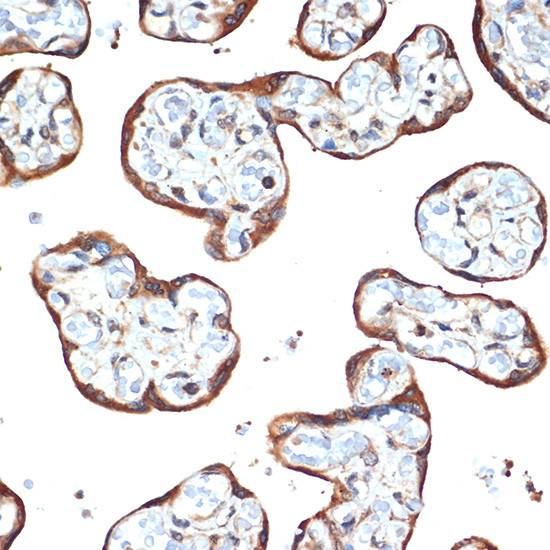 STK39 Antibody in Immunohistochemistry (Paraffin) (IHC (P))