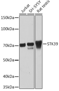 STK39 Antibody in Western Blot (WB)