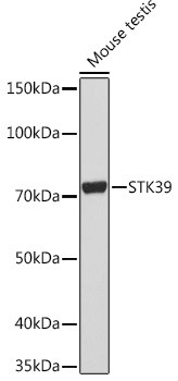 STK39 Antibody in Western Blot (WB)