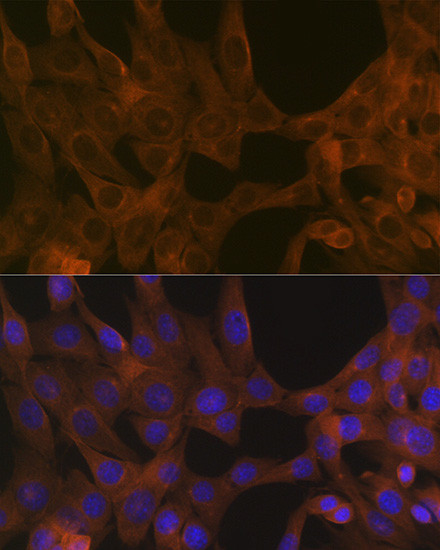 ACVR1B Antibody in Immunocytochemistry (ICC/IF)