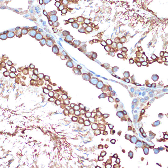 ACVR1B Antibody in Immunohistochemistry (Paraffin) (IHC (P))