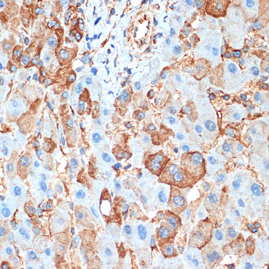 ACVR1B Antibody in Immunohistochemistry (Paraffin) (IHC (P))