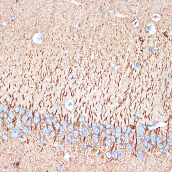 ACVR1B Antibody in Immunohistochemistry (Paraffin) (IHC (P))