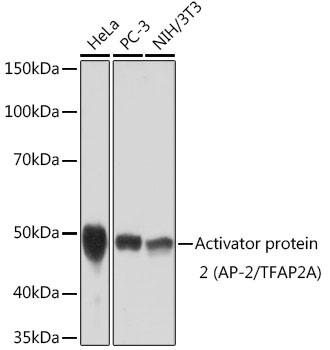 AP2 alpha Antibody in Western Blot (WB)