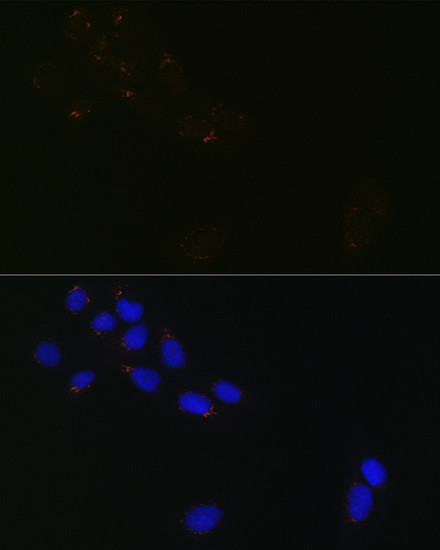 GRASP65 Antibody in Immunocytochemistry (ICC/IF)