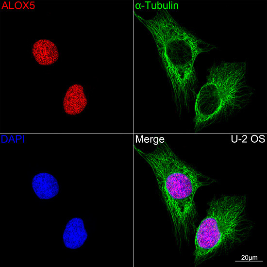 ALOX5 Antibody in Immunocytochemistry (ICC/IF)