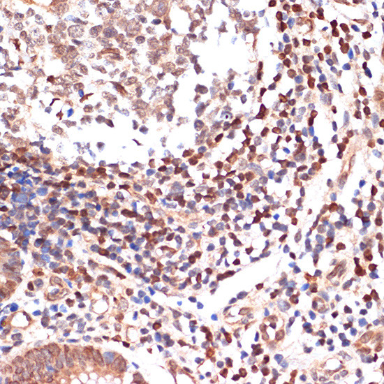 ALOX5 Antibody in Immunohistochemistry (Paraffin) (IHC (P))