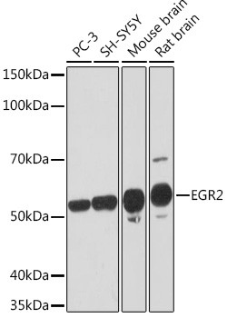 EGR2 Antibody in Western Blot (WB)