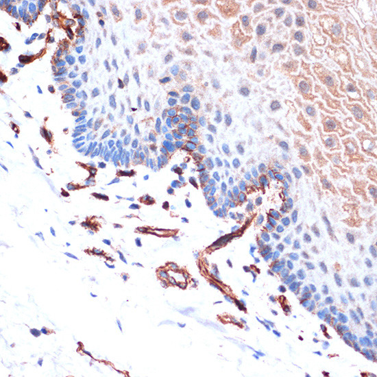 H-cadherin Antibody in Immunohistochemistry (Paraffin) (IHC (P))