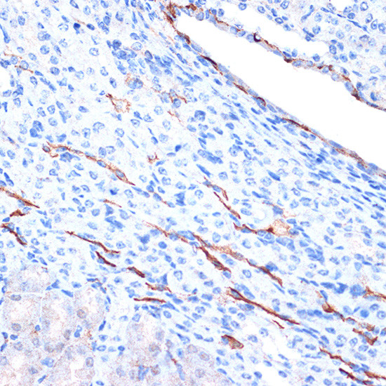 H-cadherin Antibody in Immunohistochemistry (Paraffin) (IHC (P))