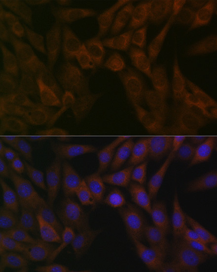 ARF5 Antibody in Immunocytochemistry (ICC/IF)