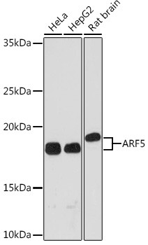 ARF5 Antibody in Western Blot (WB)