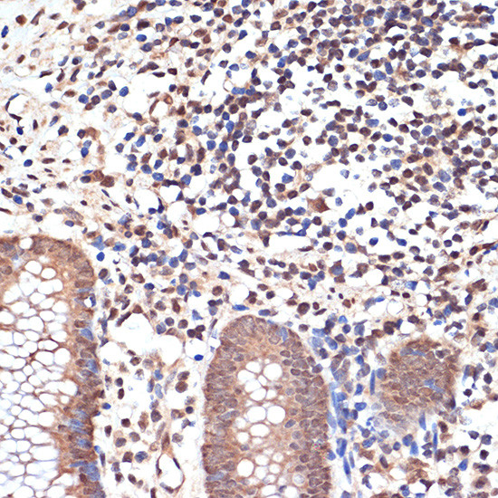 MYST1 Antibody in Immunohistochemistry (Paraffin) (IHC (P))