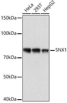 SNX1 Antibody in Western Blot (WB)