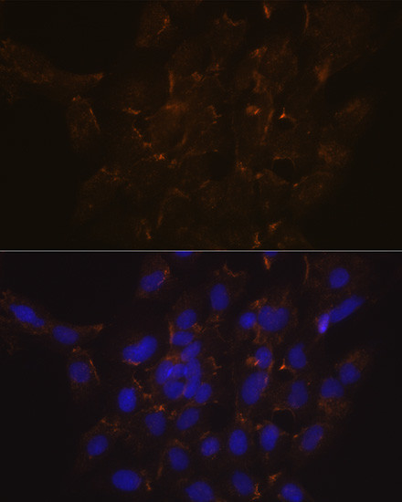 PLSCR1 Antibody in Immunocytochemistry (ICC/IF)