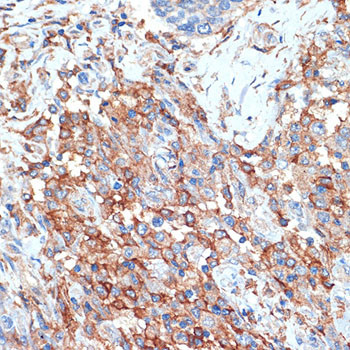 PLSCR1 Antibody in Immunohistochemistry (Paraffin) (IHC (P))