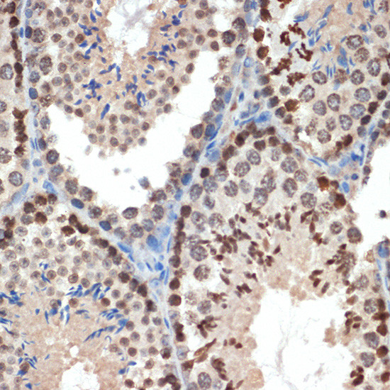 eIF3e Antibody in Immunohistochemistry (Paraffin) (IHC (P))