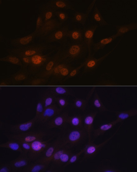 PHAPI2 Antibody in Immunocytochemistry (ICC/IF)