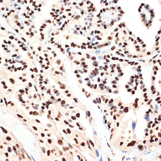 PHAPI2 Antibody in Immunohistochemistry (Paraffin) (IHC (P))