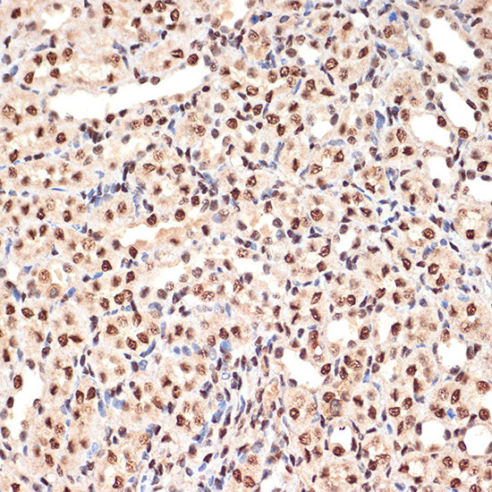 PHAPI2 Antibody in Immunohistochemistry (Paraffin) (IHC (P))