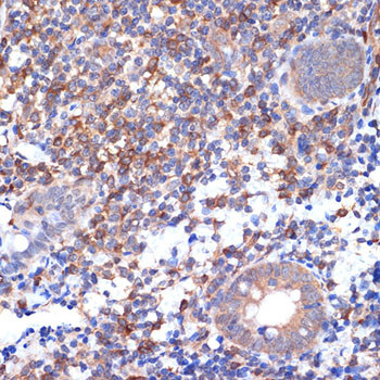 VAV2 Antibody in Immunohistochemistry (Paraffin) (IHC (P))