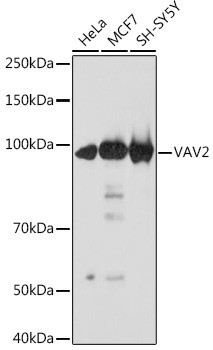 VAV2 Antibody in Western Blot (WB)