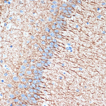 alpha Internexin Antibody in Immunohistochemistry (Paraffin) (IHC (P))