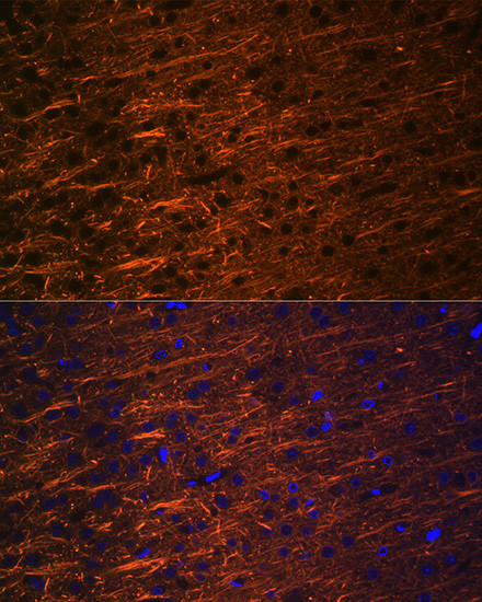 alpha Internexin Antibody in Immunohistochemistry (Paraffin) (IHC (P))