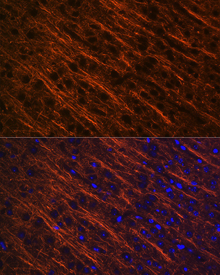 alpha Internexin Antibody in Immunohistochemistry (Paraffin) (IHC (P))